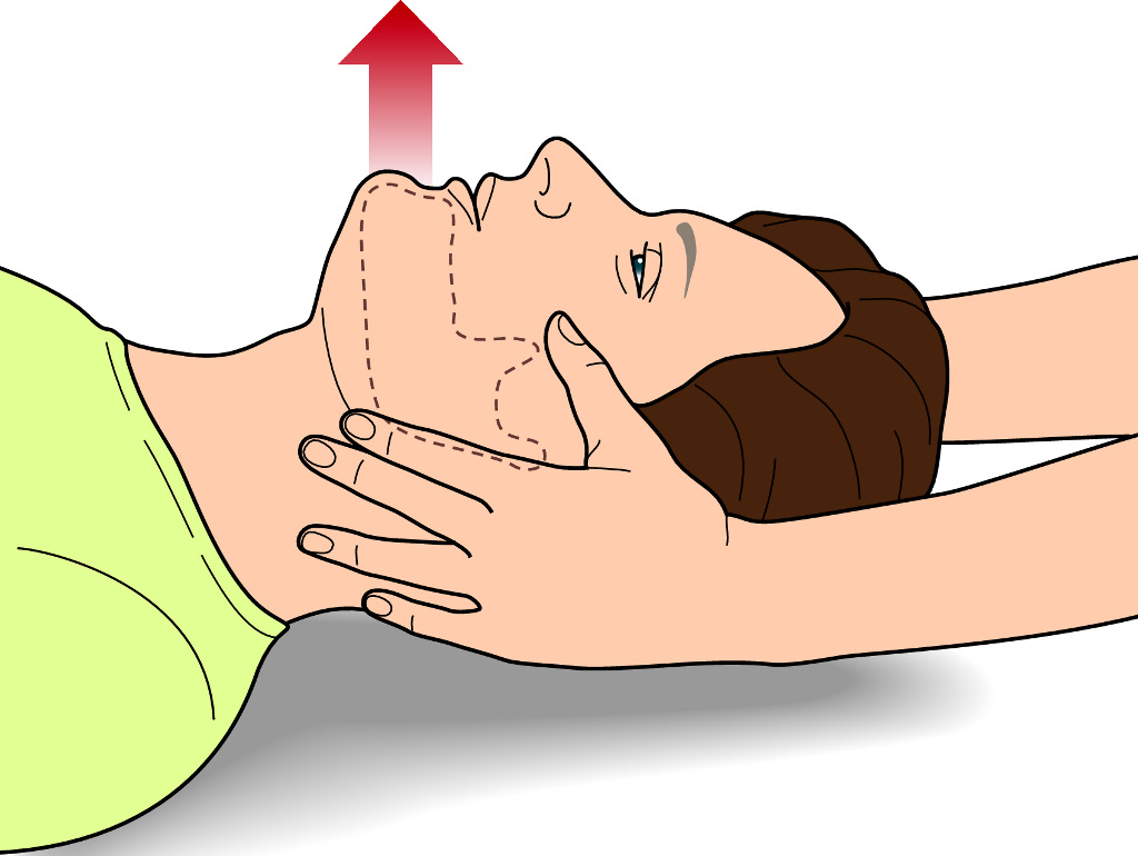 Jaw Thrust E Chin Lift - BRAINCP