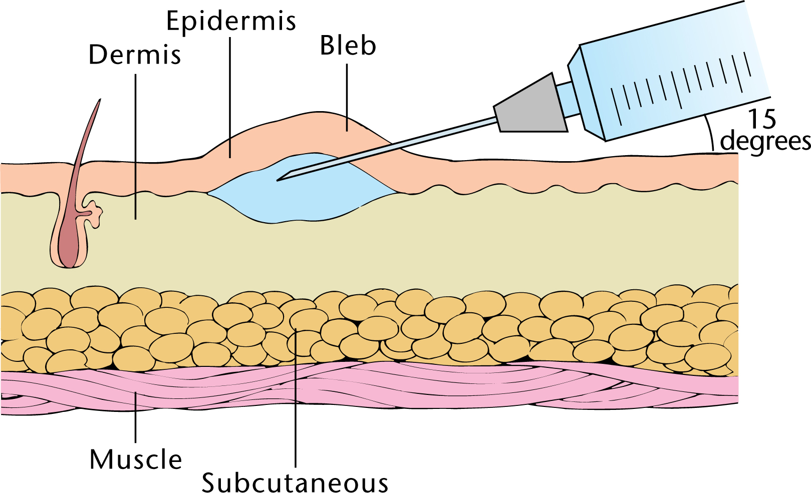 Nursing Skill Image